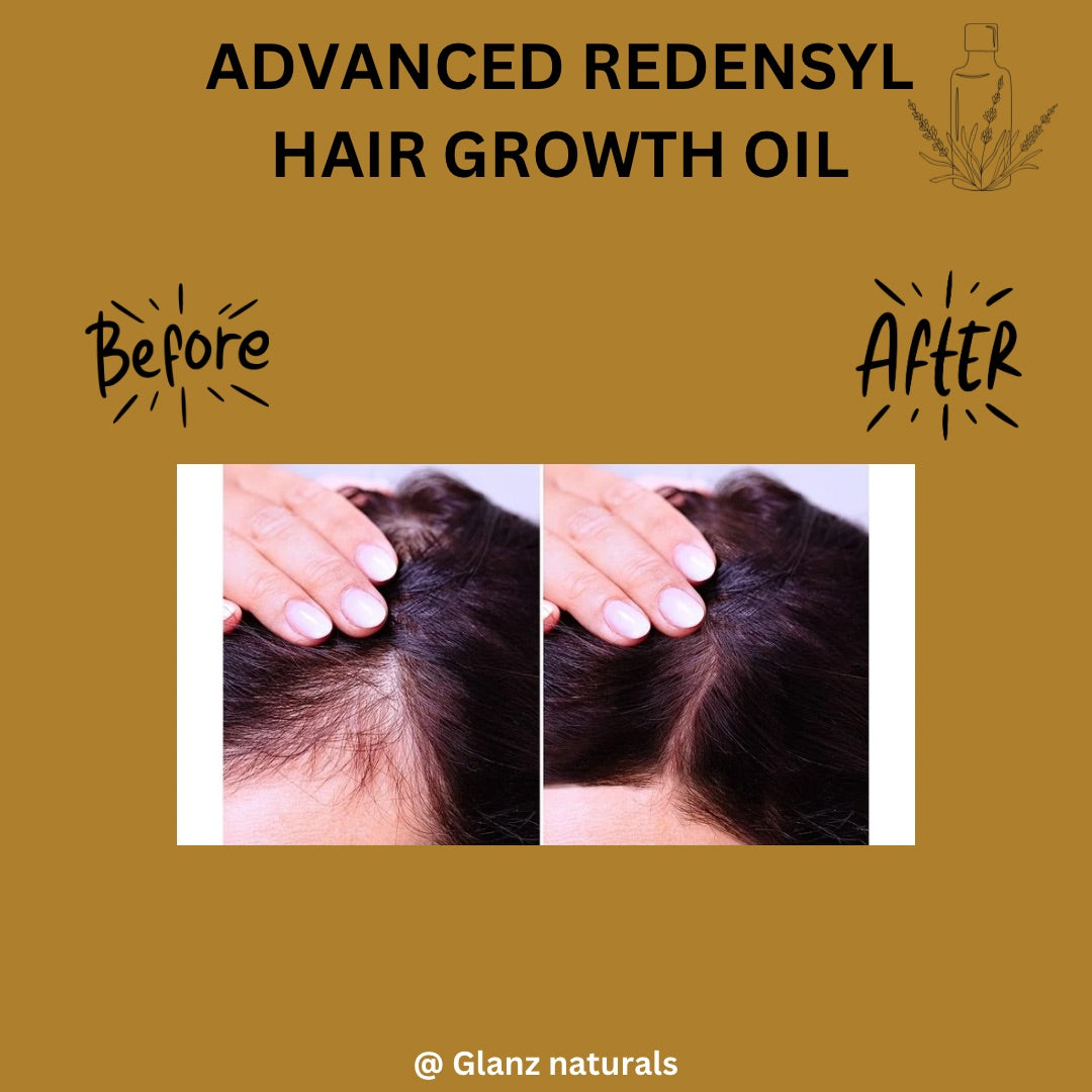 Advance redensyl 2% hair growth oil - 100 ml